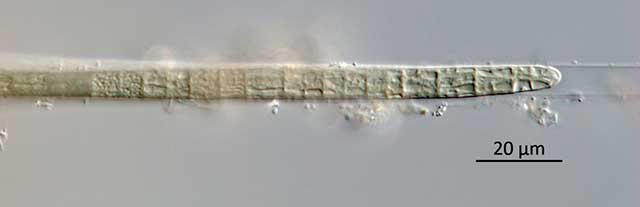Photo shows microscopic toxin