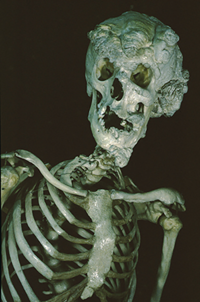photos shows a skeleton